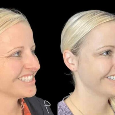 Why Clients Trust the Best Doctors in Dubai for Botox Services
