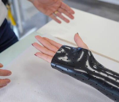 What to Expect During Your First Visit to a Hand Therapy Clinic