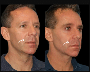 Best Plastic Surgeon in dubai