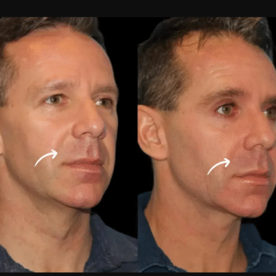 Best Plastic Surgeon in dubai
