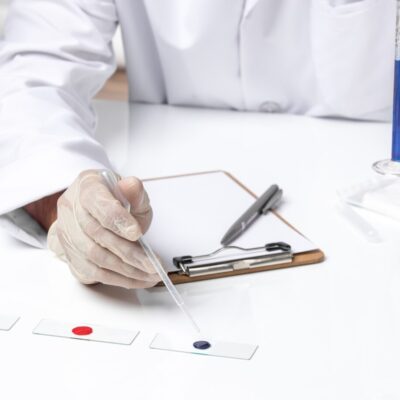 Tb Test