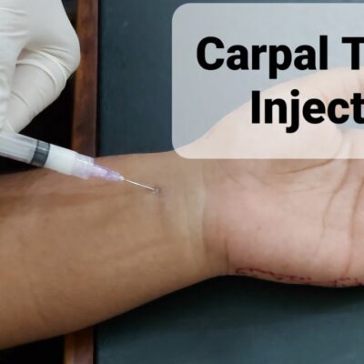 carpal tunnel injections