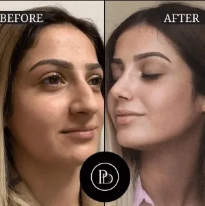 How PRP Treatments in Dubai Boost Hair Growth Naturally