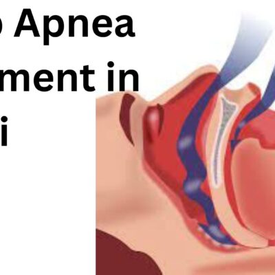 Sleep Apnea Treatment in Dubai