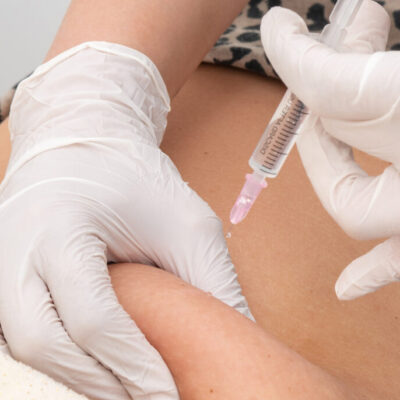 Fat Melting Injections in Dubai