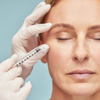 Under Eye Fillers in Dubai