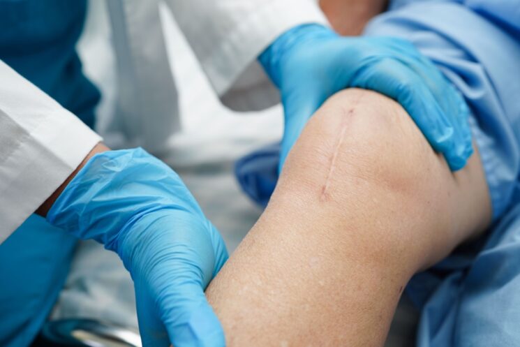 amniotic wound care products