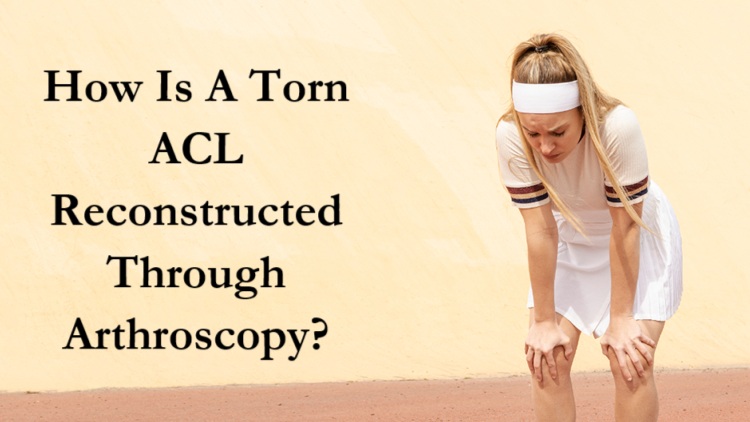 How Is A Torn ACL Reconstructed Through Arthroscopy