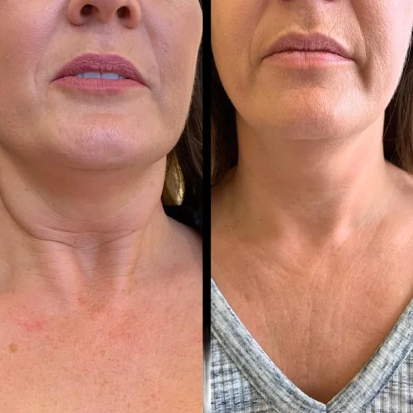 Best Plastic Surgeon in dubai