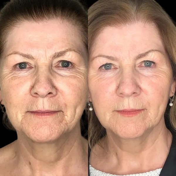 Best Aesthetic Clinics in dubai