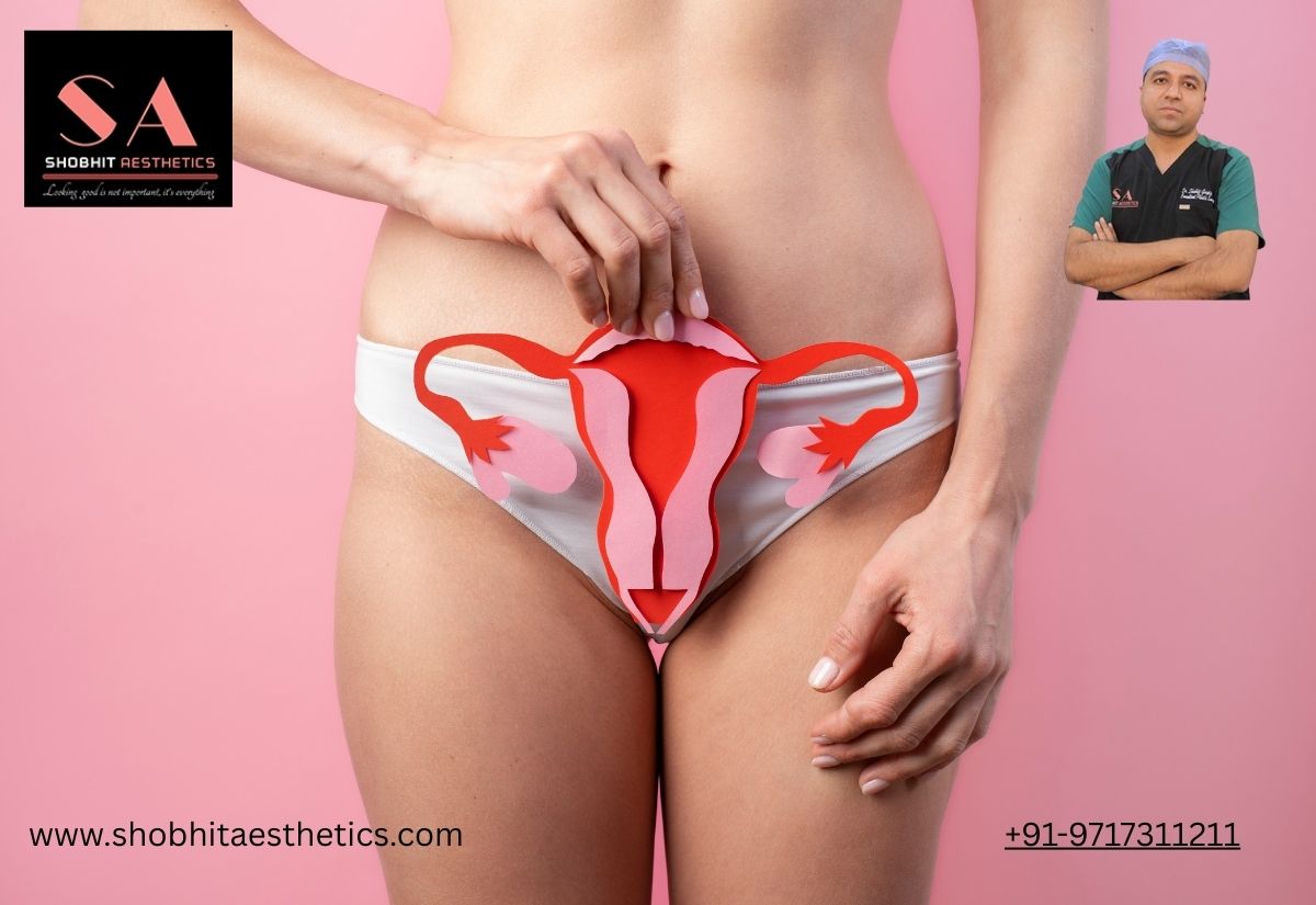 vaginoplasty cost in India