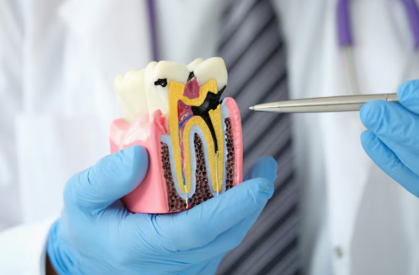 root canals raleigh nc